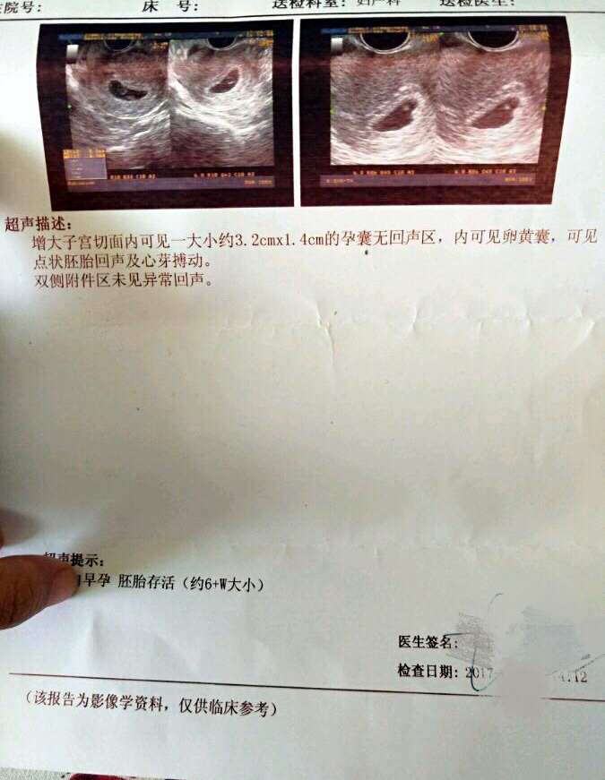 恭喜Ｌ姐供卵自怀成功