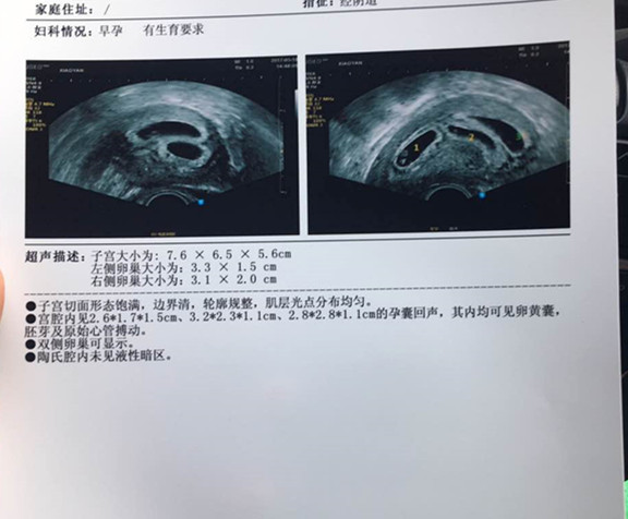 美亚麟喜不计成本不离不弃，您的托付我们的责任(图1)